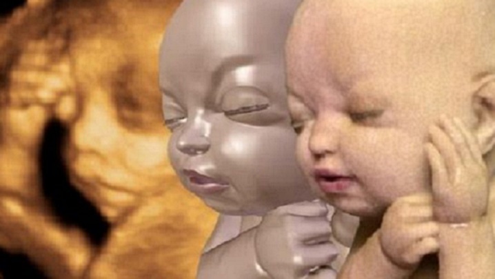 Noile tehnici 3D pot schimba dezbaterea despre avort (VIDEO)