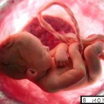 Mărturia impresionantă a supravieţuitoarei unui „avort eşuat”