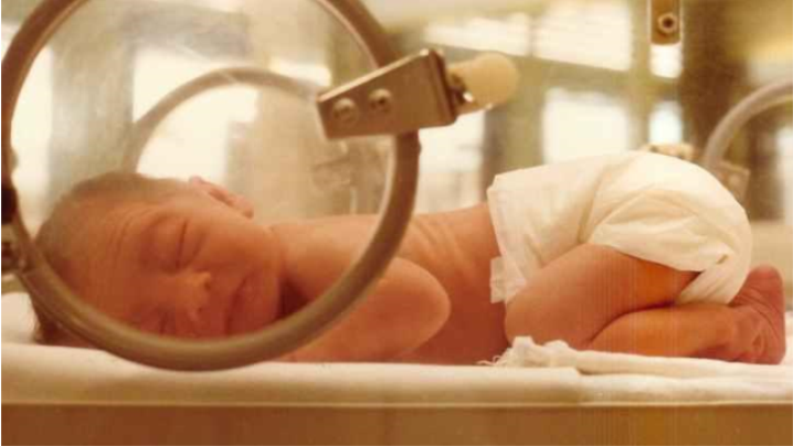 Învierea unei fetiţe premature: a supravieţuit 10 ore la congelatorul de la morgă