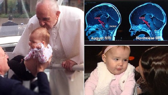 FOTO/ VIDEO: Tumoarea unei fetiţe s-a micşorat după ce Papa a sărutat-o pe creştet